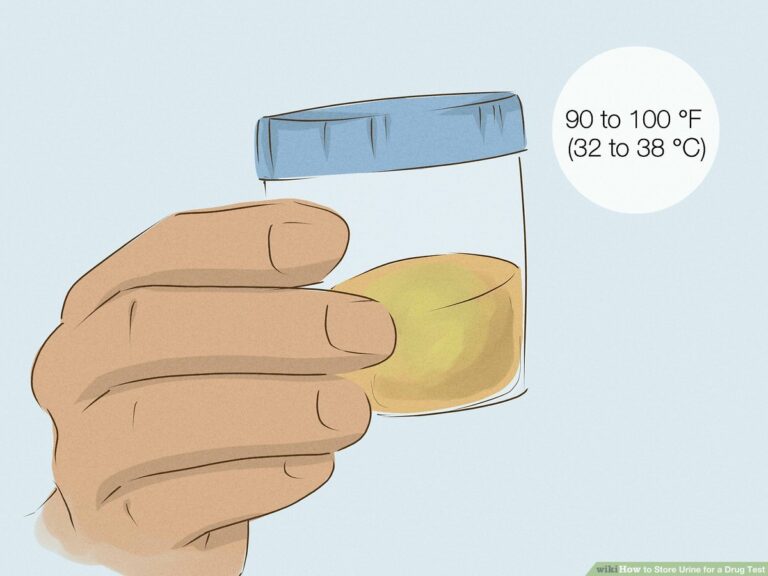 How to Keep Urine Fresh for a Drug Test?