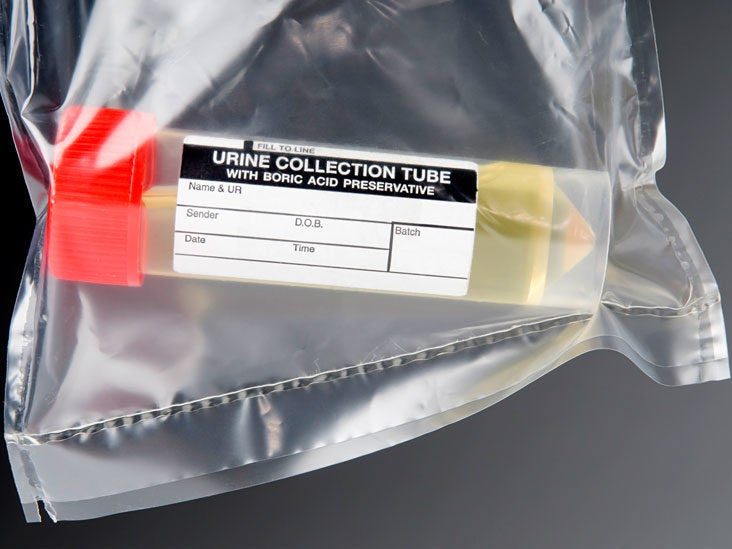 What is a Urine Drug Test?