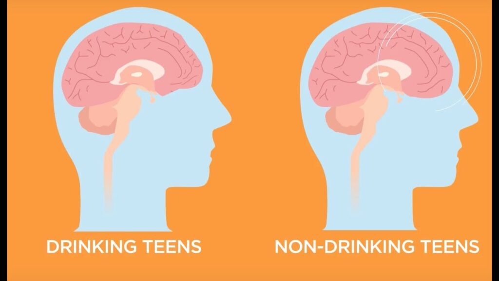 What Does Alcohol Do to a Teenage Brain